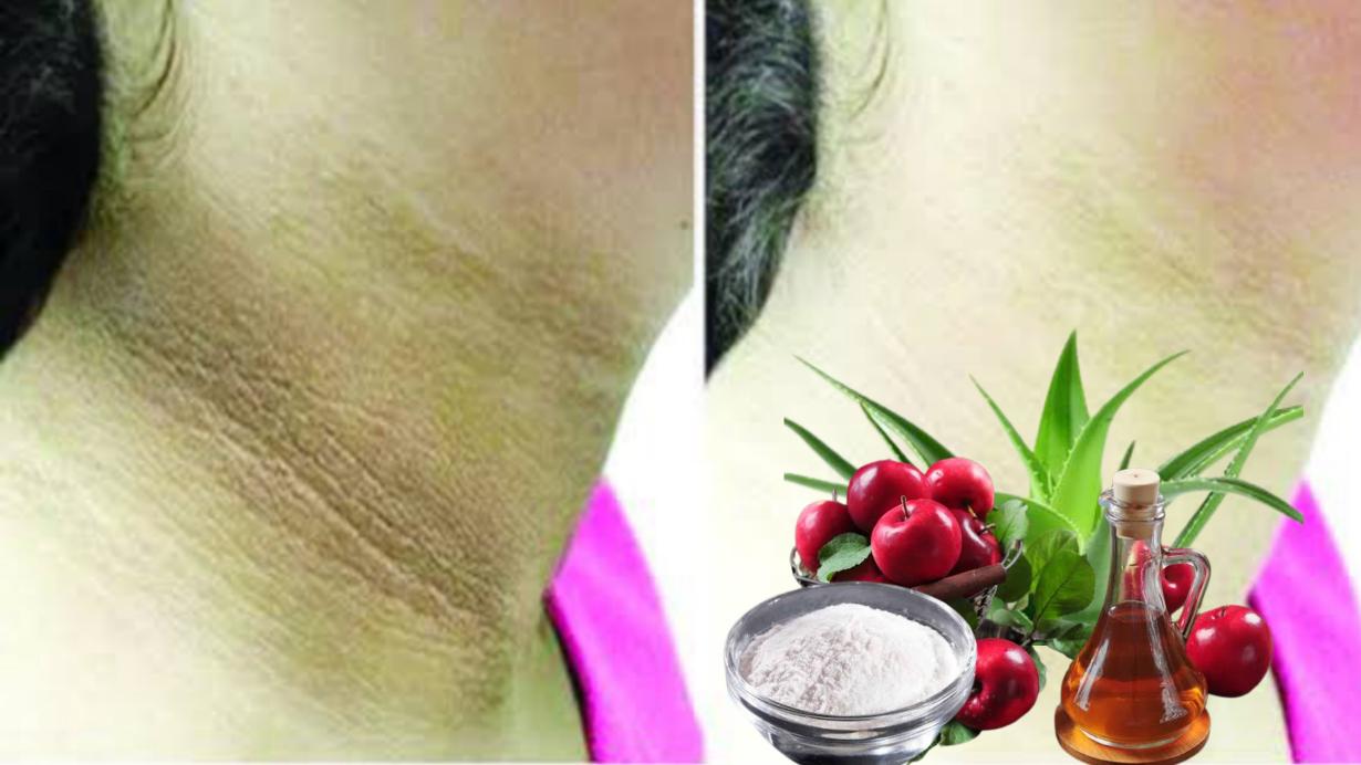 Rid of dark neck