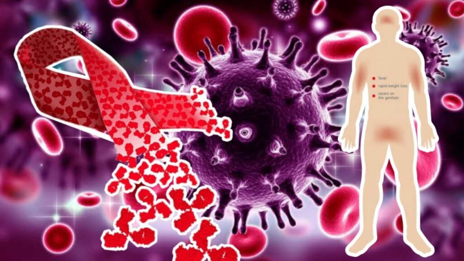HIV Infection