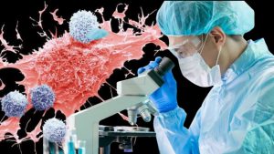 Cancer Treatment